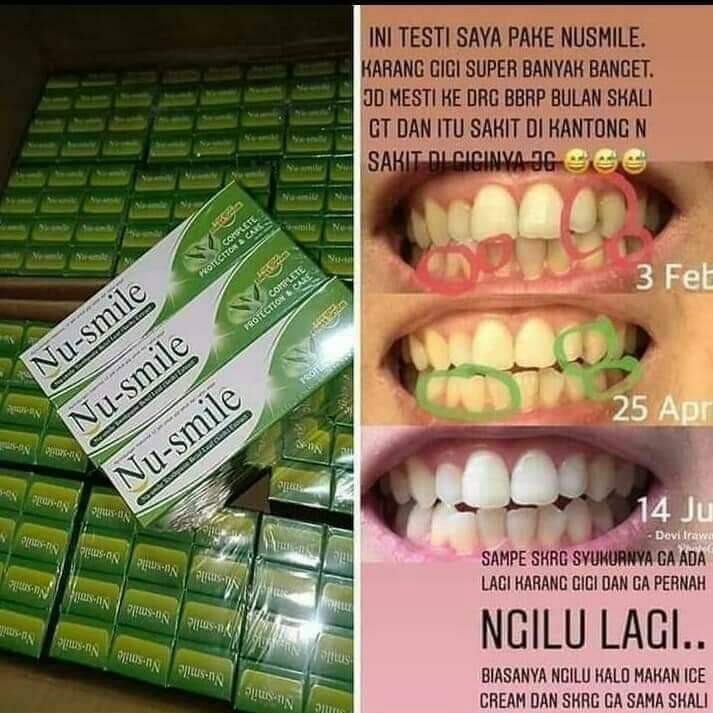 NU smile