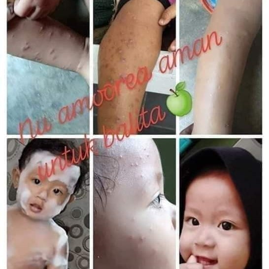 Testimoni Amoorea