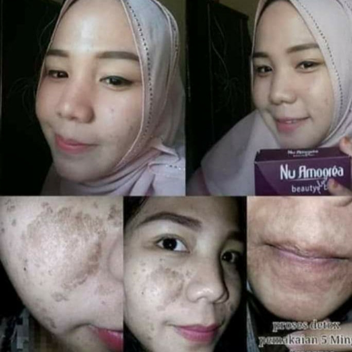 Nu Amoorea Beauty Plus Bar 3