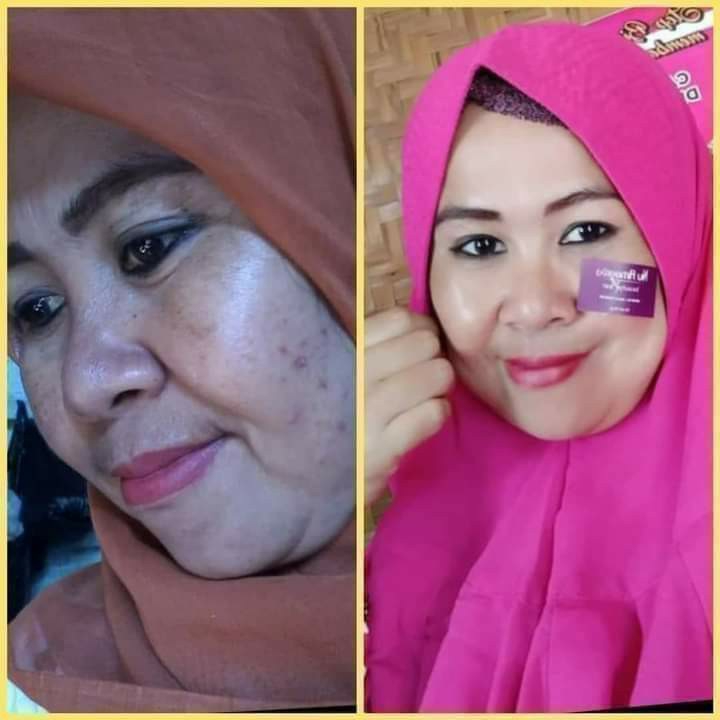 Nu Amoorea Beauty Plus Bar 5