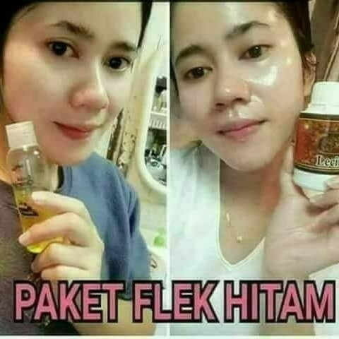 PAKET FLEK HITAM NASA