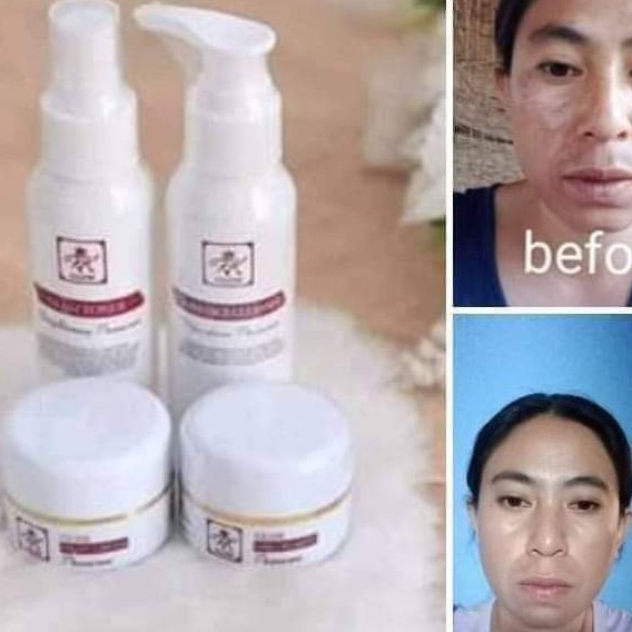 Paket cream penghilang flex hitam 3