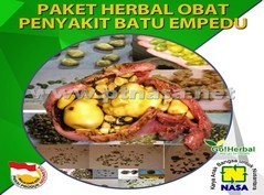 Paket Herbal Obat Penyakit Batu Empedu