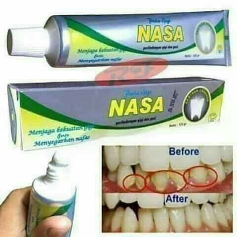 Pasta gigi nasa