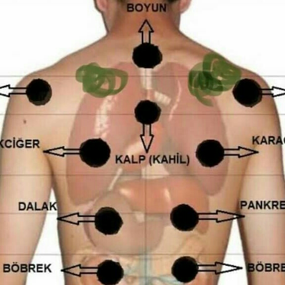 Pijat Bekam Kerik 2