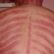 Pijat Tradisional Dan Kerik