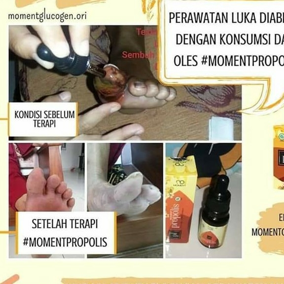 Propolis Moment 2