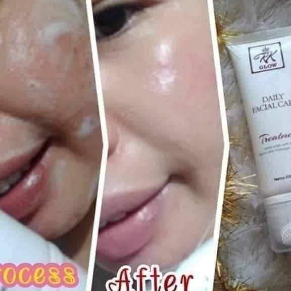 RK Treatment 2