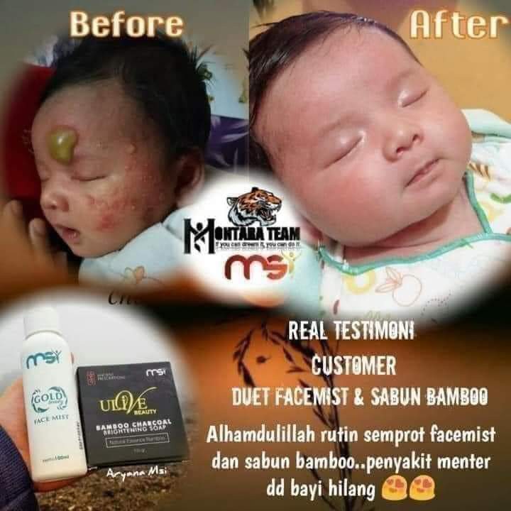 Sabun Bambo Dan Spray Facemist