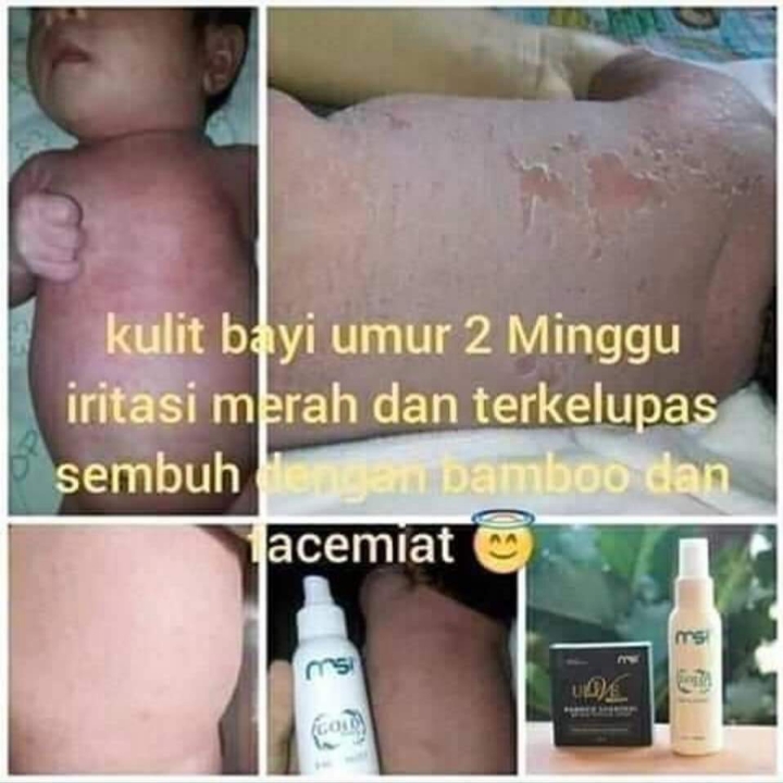 Sabun Bambo Dan Spray Facemist 2