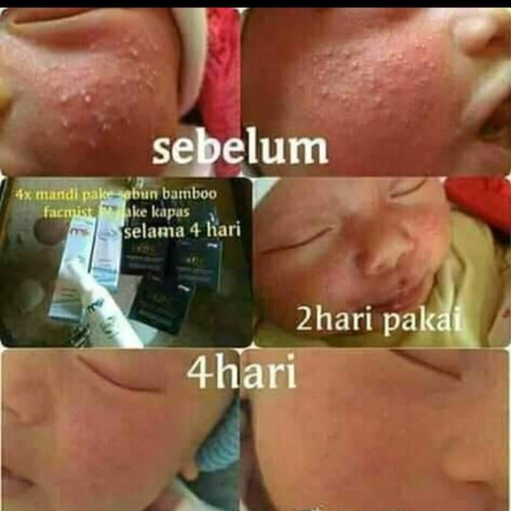 Sabun Bambo Dan Spray Facemist 3