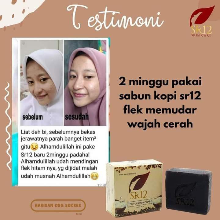 Sabun Kopi Sr12 Ampuh Atasi Flek Hitam 2