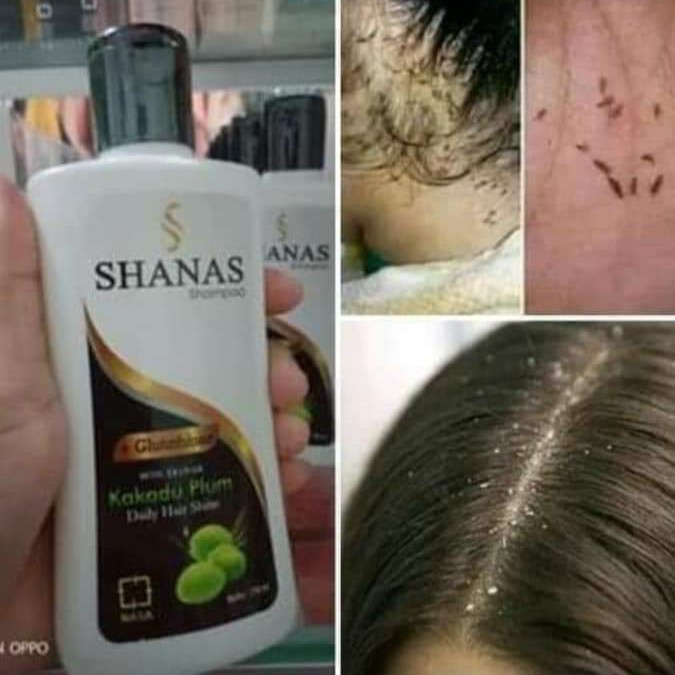 Shampo Anti Kutu Shanas