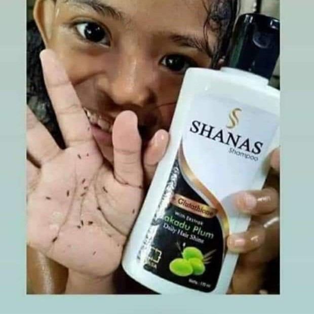 Shampo Anti Kutu Shanas 2