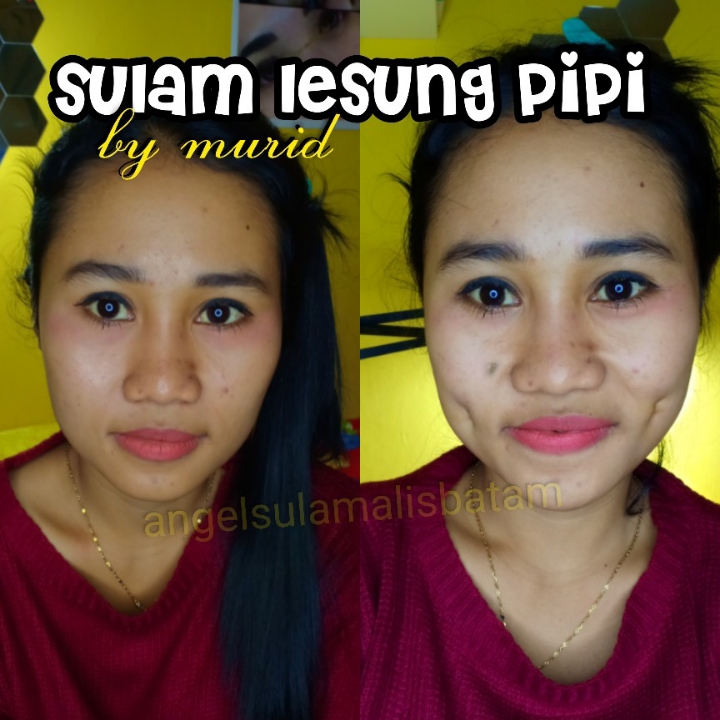 Sulam Lesung Pipi