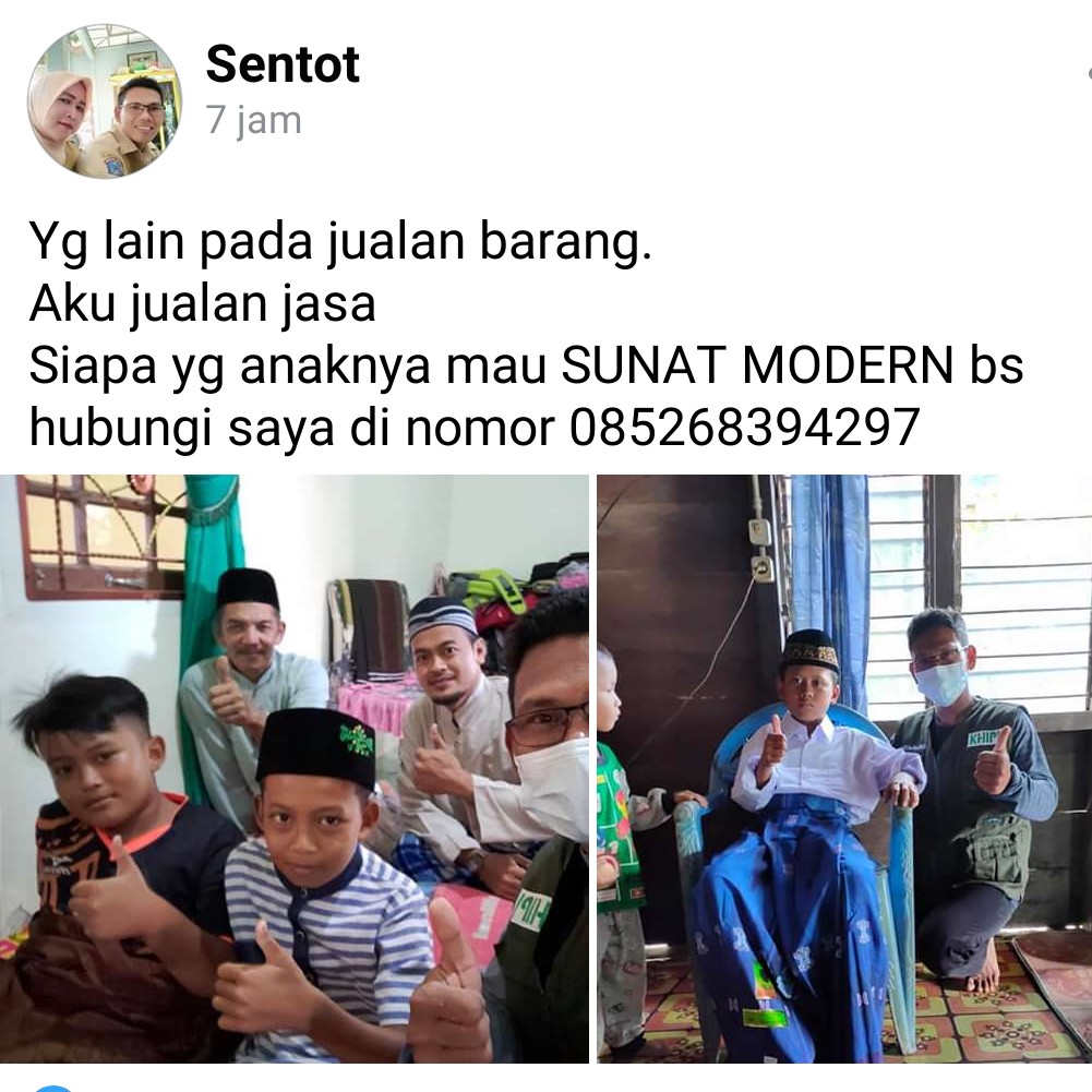 Sunat Modern