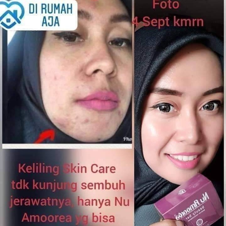 Testi Nu Amoorea