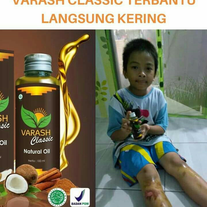 Varash Classic 