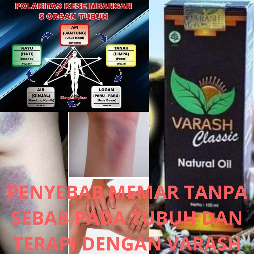 Varash Classic