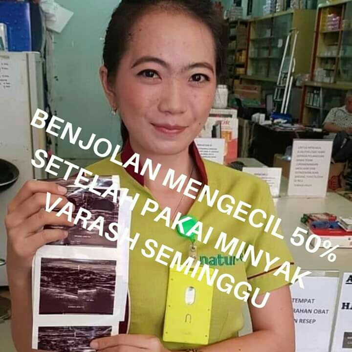 Varash Untuk Benjolan Pada Payudara 