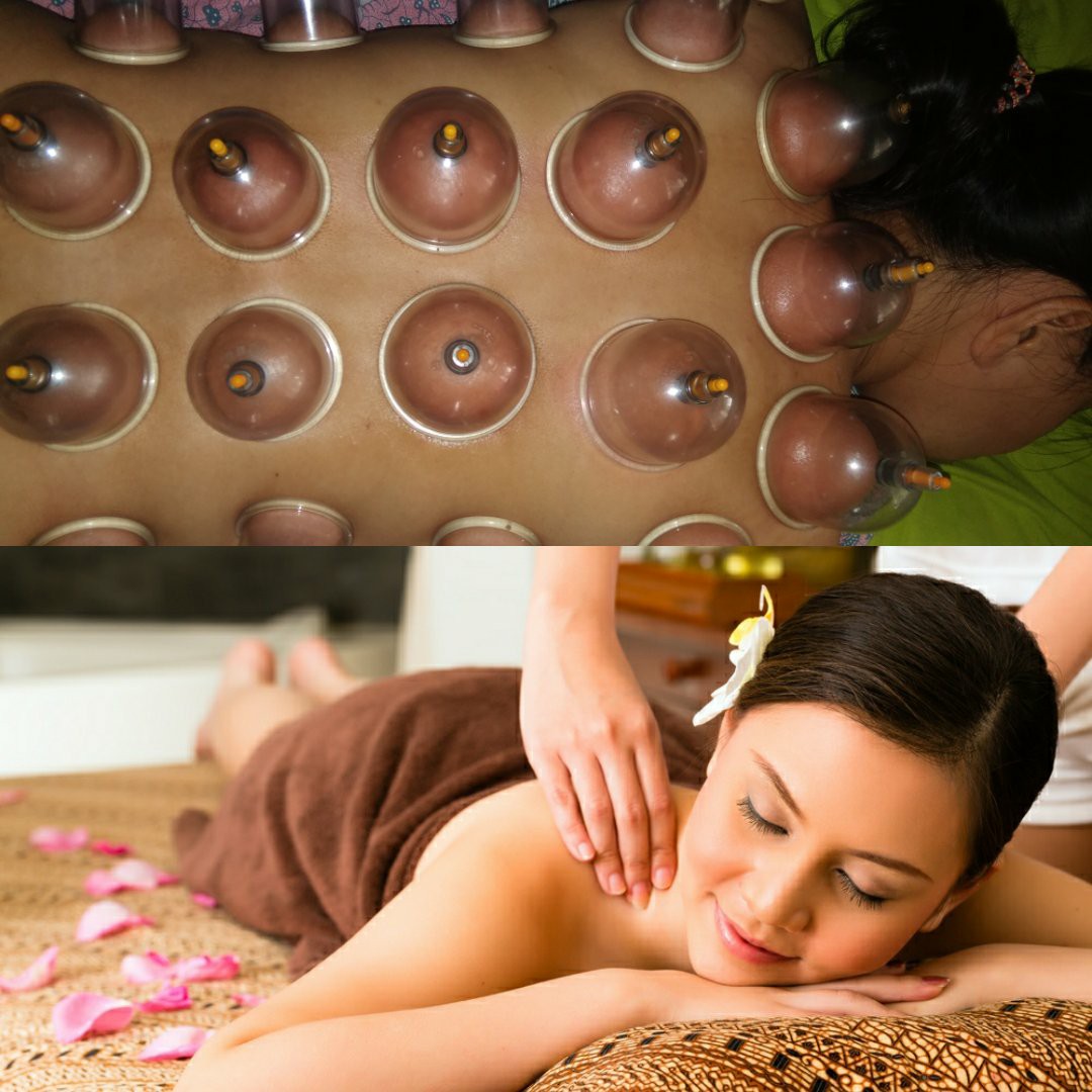 massage bekam kering atau kerikan Rp 160 000